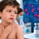 Measles cases rising in the US in 2026 symptoms and vaccination awareness