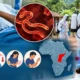 Bundibugyo Ebola virus outbreak response and symptoms overview